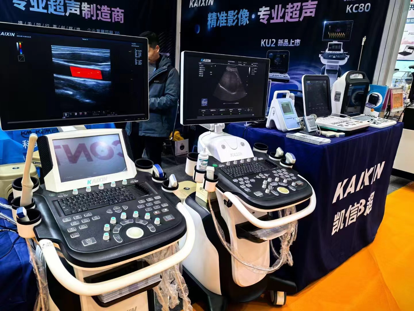 肾结石临床上的超声检查